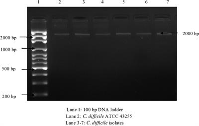 Toxinotyping and Sequencing of Clostridium difficile Isolates from Patients in a Tertiary Care Hospital of Northern India